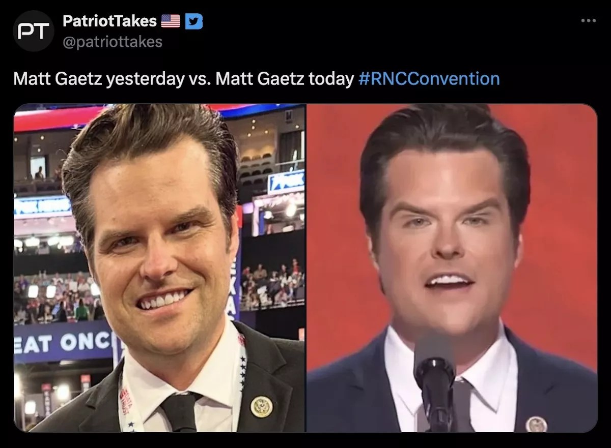Side by side "before and after" photos of U.S. Rep. Matt Gaetz's face.